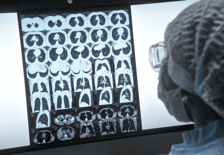 Игра в цифры, или Что делать, если появилась одышка